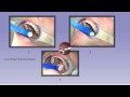 RPE (Expander) Instruction